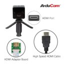 Arducam B0250 Complete High Quality Camera Bundle